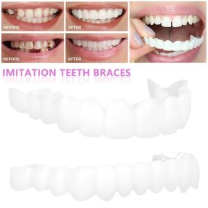 High Quality Snap-On Dentures Kit for a Confident Smile