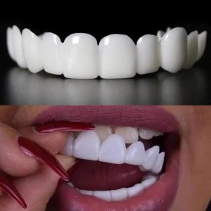 Perfect Smile Pro - Snap On Smile Veneers ( Upper & Lower Set )