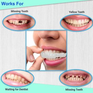 Dental Veneers - Transform Your Smile Instantly With Upper & Lower Snap-On