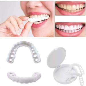 Veneers - For A Perfect Smile - Snap On Upper & Lower Set